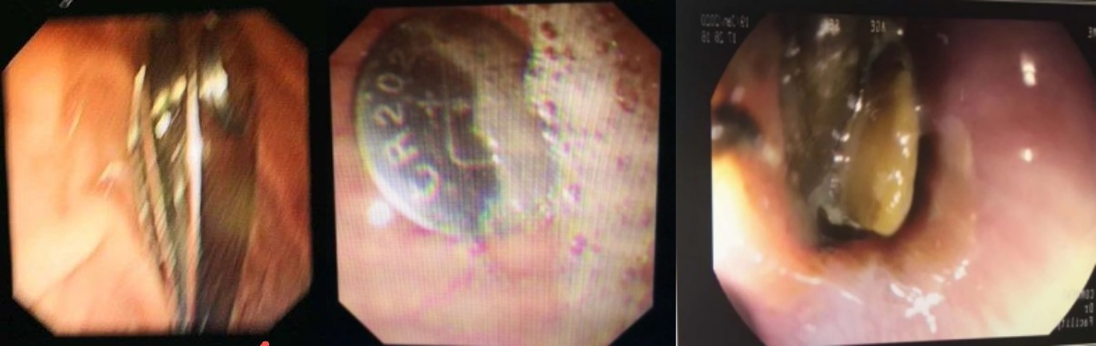 03_副本.jpg 03_副本.jpg